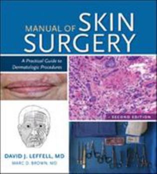 Paperback Manual of Skin Surgery: A Practical Guide to Dermatologic Procedures Book