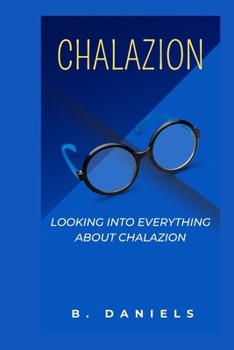Paperback Chalazion: Looking Into Everything about Chalazion Book