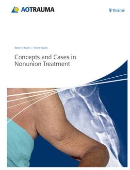 Hardcover Concepts and Cases in Nonunion Treatment Book