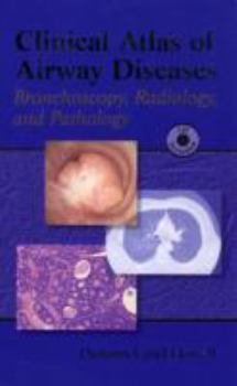 Clinical Atlas of Airway Disease: Bronchoscopy, Radiology and Pathology