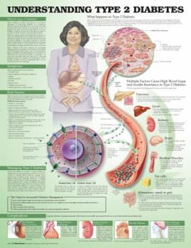 Wall Chart Understanding Type 2 Diabetes Anatomical Chart Book