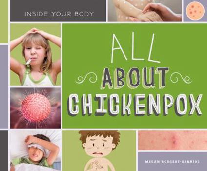 All about Chickenpox - Book  of the Inside Your Body