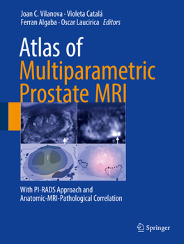 Hardcover Atlas of Multiparametric Prostate MRI: With Pi-Rads Approach and Anatomic-Mri-Pathological Correlation Book