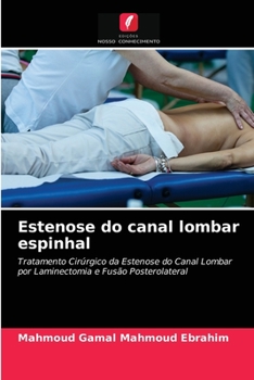 Paperback Estenose do canal lombar espinhal [Portuguese] Book