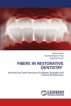 Fibers in Restorative Dentistry
