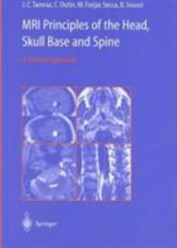 Hardcover MRI Principles of the Head, Skull Base and Spine: A Clinical Approach Book