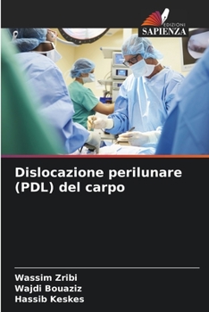 Paperback Dislocazione perilunare (PDL) del carpo [Italian] Book