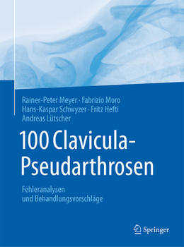 Hardcover 100 Clavicula-Pseudarthrosen: Fehleranalysen Und Behandlungsvorschläge [German] Book