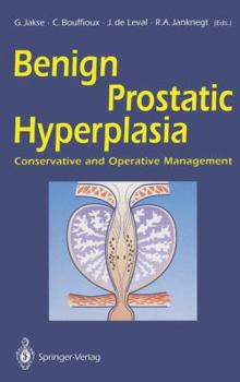 Paperback Benign Prostatic Hyperplasia: Conservative and Operative Management Book