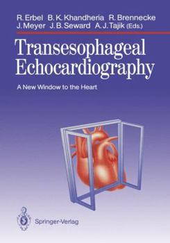 Paperback Transesophageal Echocardiography: A New Window to the Heart Book