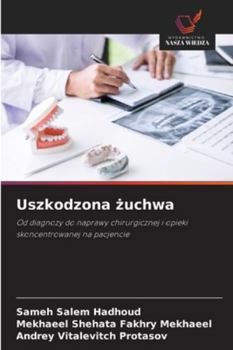 Paperback Uszkodzona żuchwa [Polish] Book