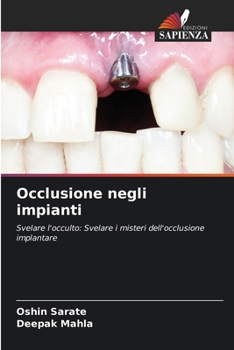 Paperback Occlusione negli impianti [Italian] Book
