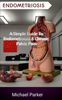 Paperback Endometriosis: A Simple Guide to Endometriosis & Chronic Pelvic Pain Book