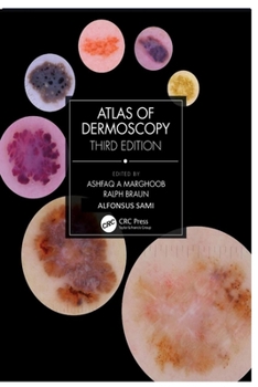 Paperback Atlas of Dermoscopy: Third Edition Book