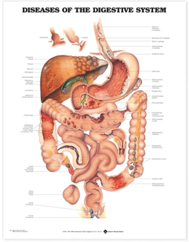 Wall Chart Diseases of the Digestive System Anatomical Chart Book