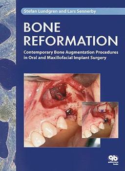 Hardcover Bone Reformation: Contemporary Bone Augmentation Procedures in Oral and Maxillofacial Implant Surgery Book