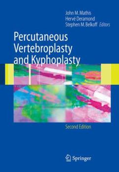Hardcover Percutaneous Vertebroplasty and Kyphoplasty Book
