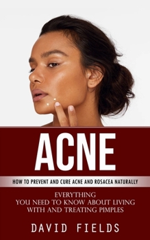 Paperback Acne: How to Prevent and Cure Acne and Rosacea Naturally (Everything You Need to Know About Living With and Treating Pimples Book