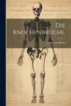 Paperback Die Knochenbrüche. [German] Book