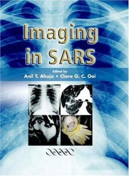 Hardcover Imaging in Sars Book