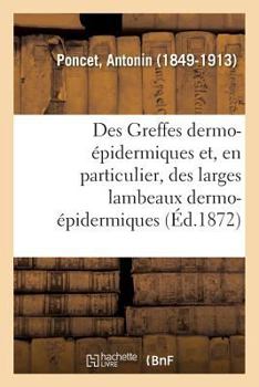 Paperback Des Greffes Dermo-Épidermiques Et, En Particulier, Des Larges Lambeaux Dermo-Épidermiques [French] Book