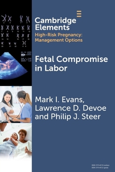 Paperback Fetal Compromise in Labor Book