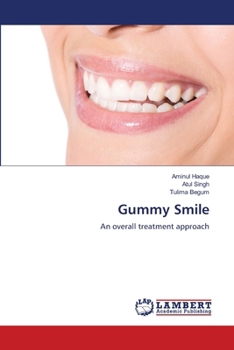 Paperback Gummy Smile Book