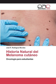 Paperback Historia Natural del Melanoma cutáneo [Spanish] Book