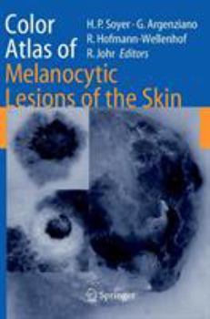 Hardcover Color Atlas of Melanocytic Lesions of the Skin Book