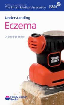 Paperback Understanding Eczema Book