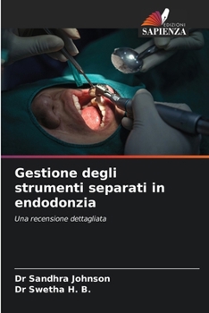Gestione degli strumenti separati in endodonzia (Italian Edition)