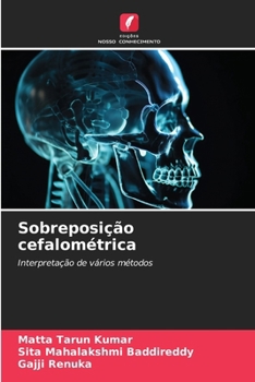 Sobreposição cefalométrica