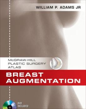Hardcover Breast Augmentation (McGraw-Hill Plastic Surgery Atlas Series) Book