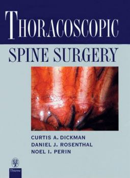 Hardcover Thoracoscopic Spine Surgery: Book