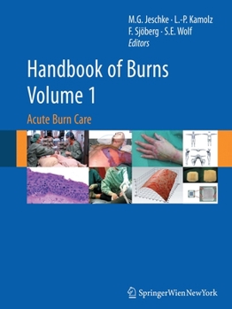 Paperback Handbook of Burns, Volume 1: Acute Burn Care Book