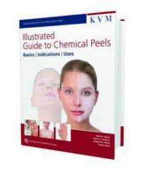 Hardcover Illustrated Guide to Chemical Peels: Basics - Indications - Uses Book