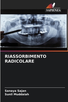Paperback Riassorbimento Radicolare [Italian] Book