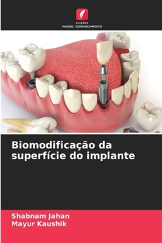 Biomodificação da superfície do implante (Portuguese Edition)