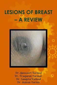 Paperback Lesions of Breast - A Review Book