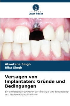 Paperback Versagen von Implantaten: Gründe und Bedingungen [German] Book