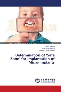 Paperback Determination of 'Safe Zone' for Implantation of Micro-Implants Book