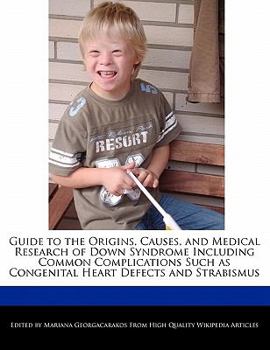 Paperback Guide to the Origins, Causes, and Medical Research of Down Syndrome Including Common Complications Such as Congenital Heart Defects and Strabismus Book