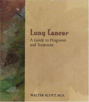 Paperback Lung Cancer: A Guide to Diagnosis and Treatment Book
