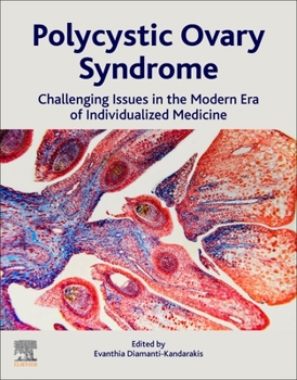 Paperback Polycystic Ovary Syndrome: Challenging Issues in the Modern Era of Individualized Medicine Book