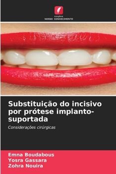 Paperback Substituição do incisivo por prótese implanto-suportada [Portuguese] Book