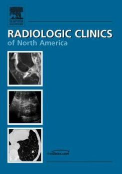 Hardcover Prostate Imaging, an Issue of Radiologic Clinics: Volume 44-5 Book