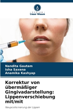 Paperback Korrektur von übermäßiger Gingivadarstellung: Lippenverschiebung mit/mit [German] Book