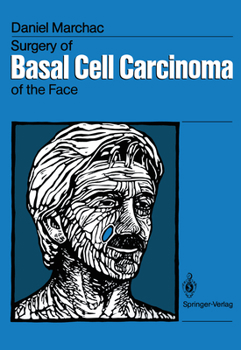 Paperback Surgery of Basal Cell Carcinoma of the Face Book