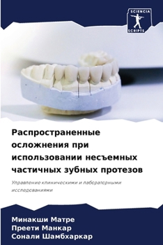 Paperback Распространенные ослож&# [Russian] Book