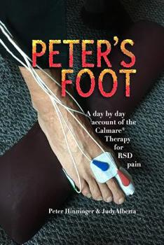 Peter's Foot : Calmare Treatment for RSD Pain Relief